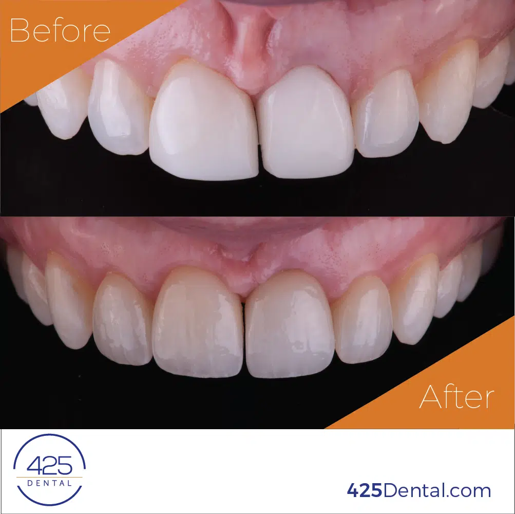 425-Dr-Ansong-Updated-BAs-Case-4-v4_1080x1080
